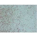 Immunohistochemistry - Anti-ZAP70 Antibody (V0141) - Antibodies.com