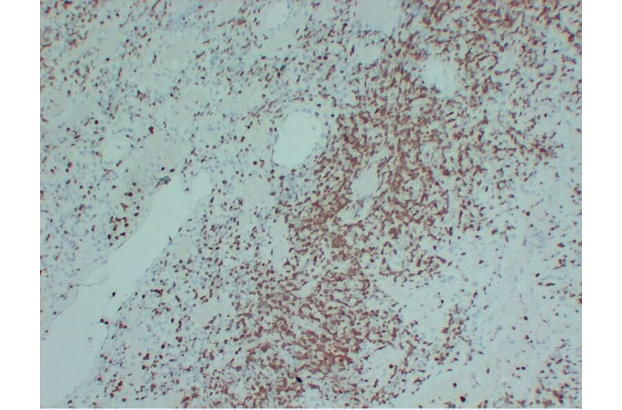 Immunohistochemistry - Anti-ZAP70 Antibody (V0141) - Antibodies.com
