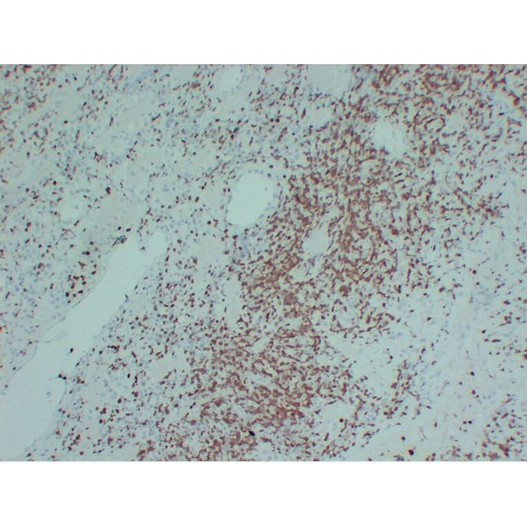 Immunohistochemistry - Anti-ZAP70 Antibody (V0141) - Antibodies.com