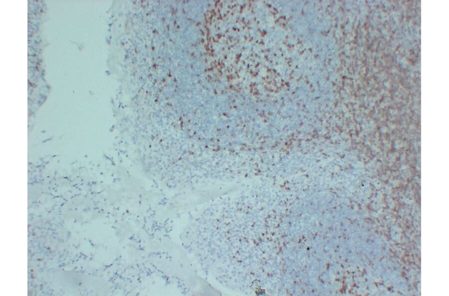 Immunohistochemistry - Anti-ZAP70 Antibody (V0141) - Antibodies.com