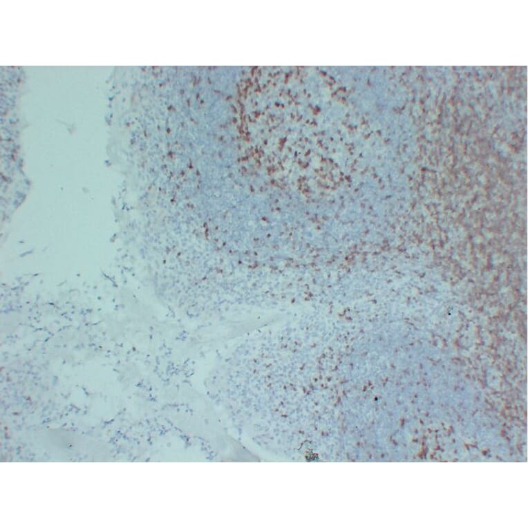 Immunohistochemistry - Anti-ZAP70 Antibody (V0141) - Antibodies.com