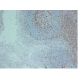 Immunohistochemistry - Anti-ZAP70 Antibody (V0141) - Antibodies.com