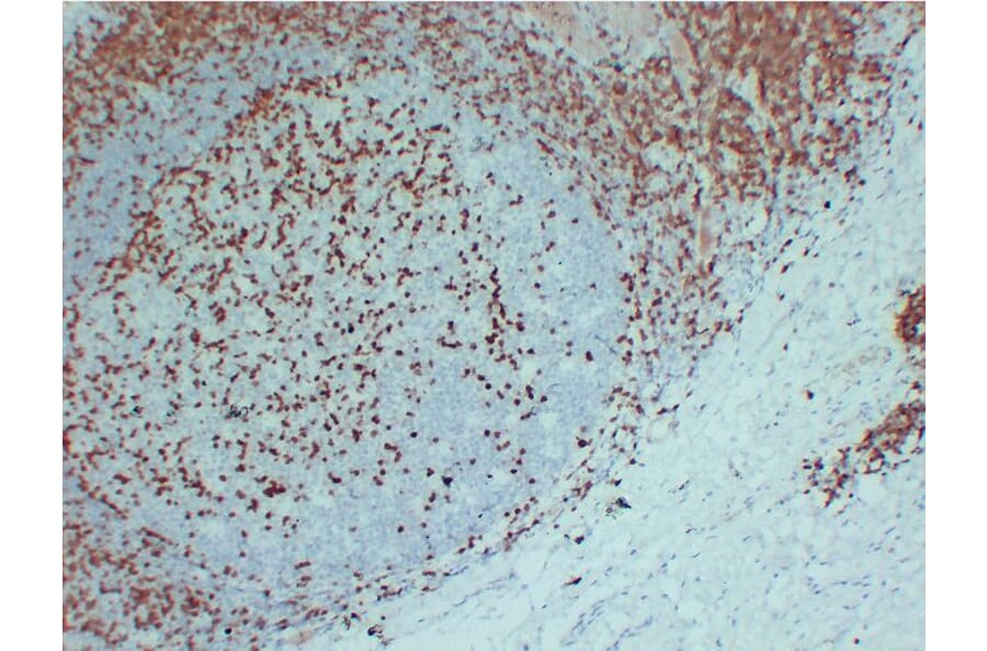 Immunohistochemistry - Anti-ZAP70 Antibody (V0141) - Antibodies.com