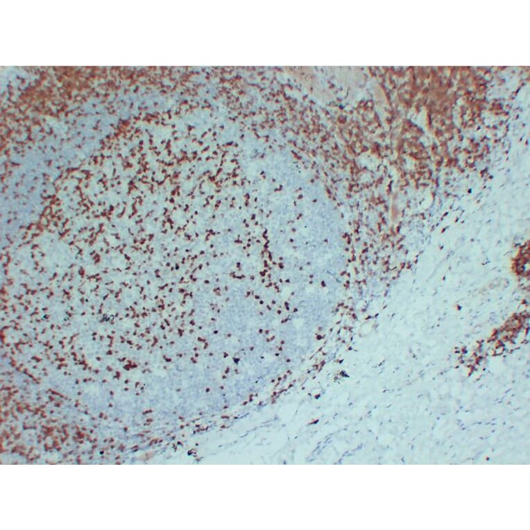 Immunohistochemistry - Anti-ZAP70 Antibody (V0141) - Antibodies.com