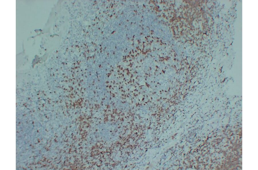 Immunohistochemistry - Anti-ZAP70 Antibody (V0141) - Antibodies.com