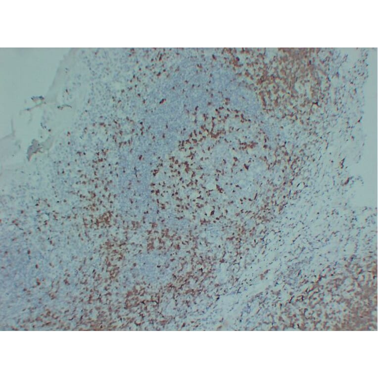 Immunohistochemistry - Anti-ZAP70 Antibody (V0141) - Antibodies.com