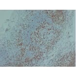 Immunohistochemistry - Anti-ZAP70 Antibody (V0141) - Antibodies.com