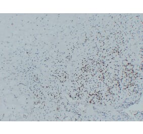 Immunohistochemistry - Anti-MyoD1 Antibody (V0100) - Antibodies.com