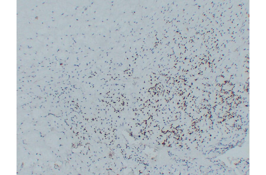 Immunohistochemistry - Anti-MyoD1 Antibody (V0100) - Antibodies.com