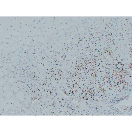 Immunohistochemistry - Anti-MyoD1 Antibody (V0100) - Antibodies.com