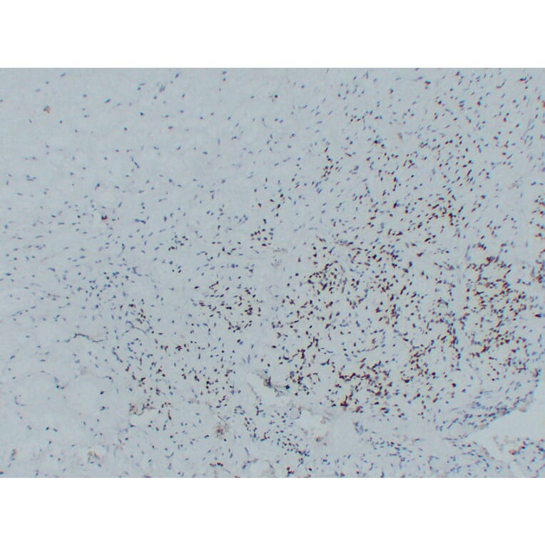 Immunohistochemistry - Anti-MyoD1 Antibody (V0100) - Antibodies.com