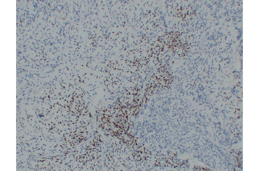 Immunohistochemistry - Anti-MyoD1 Antibody (V0100) - Antibodies.com
