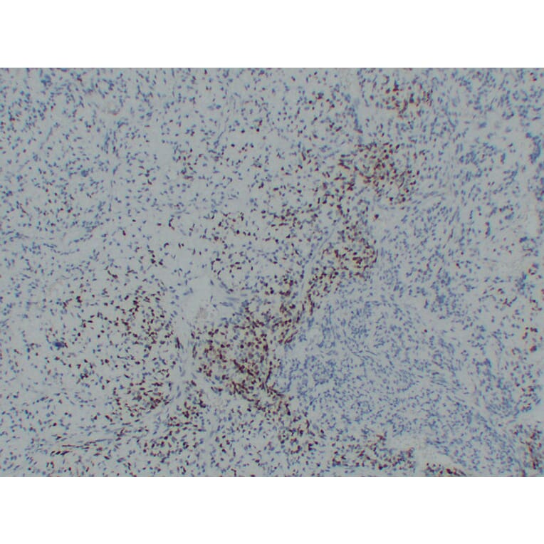 Immunohistochemistry - Anti-MyoD1 Antibody (V0100) - Antibodies.com