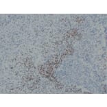 Immunohistochemistry - Anti-MyoD1 Antibody (V0100) - Antibodies.com