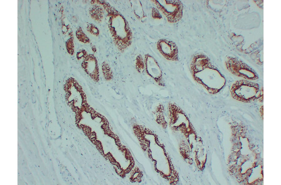 Immunohistochemistry - Anti-AMACR Antibody (V0006) - Antibodies.com