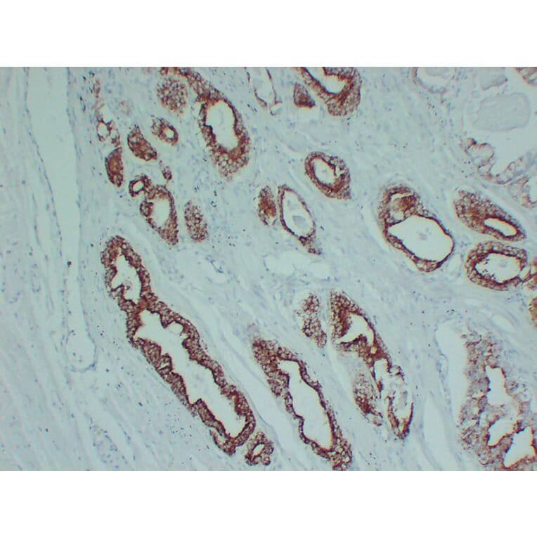 Immunohistochemistry - Anti-AMACR Antibody (V0006) - Antibodies.com