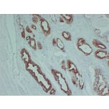 Immunohistochemistry - Anti-AMACR Antibody (V0006) - Antibodies.com