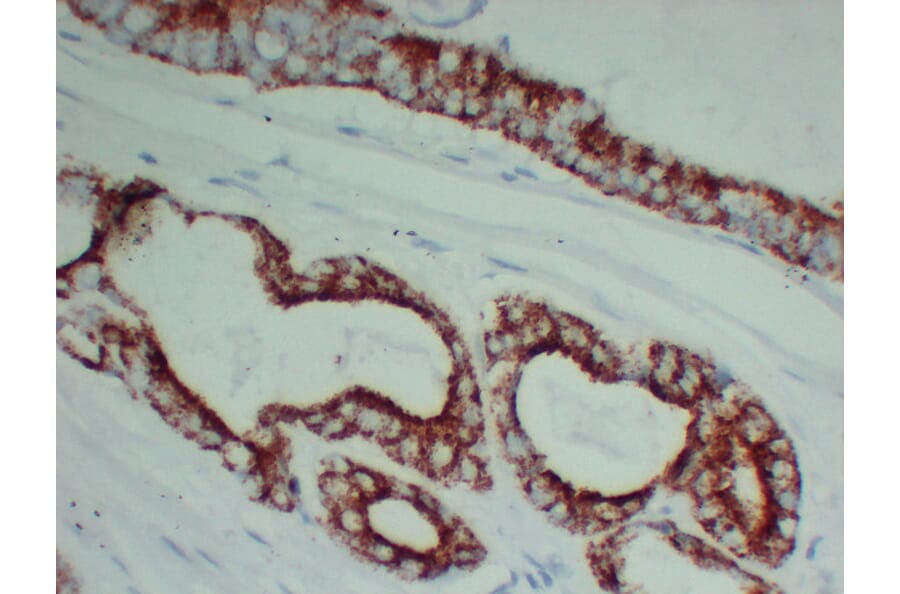 Immunohistochemistry - Anti-AMACR Antibody (V0006) - Antibodies.com