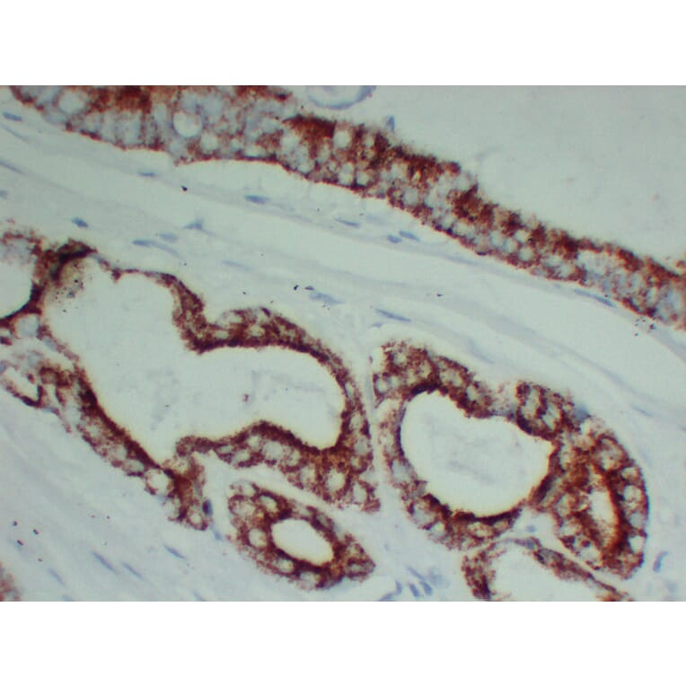 Immunohistochemistry - Anti-AMACR Antibody (V0006) - Antibodies.com
