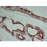 Immunohistochemistry - Anti-AMACR Antibody (V0006) - Antibodies.com