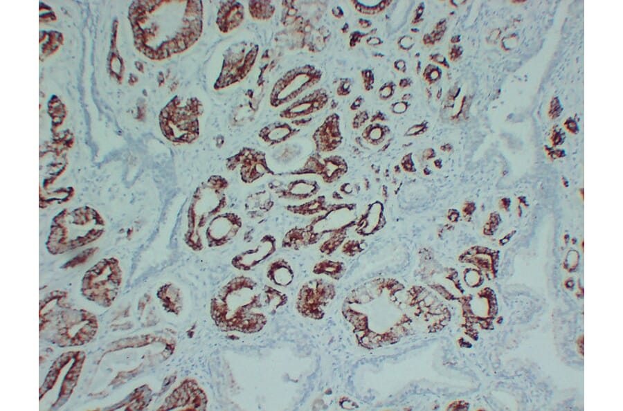 Immunohistochemistry - Anti-AMACR Antibody (V0006) - Antibodies.com