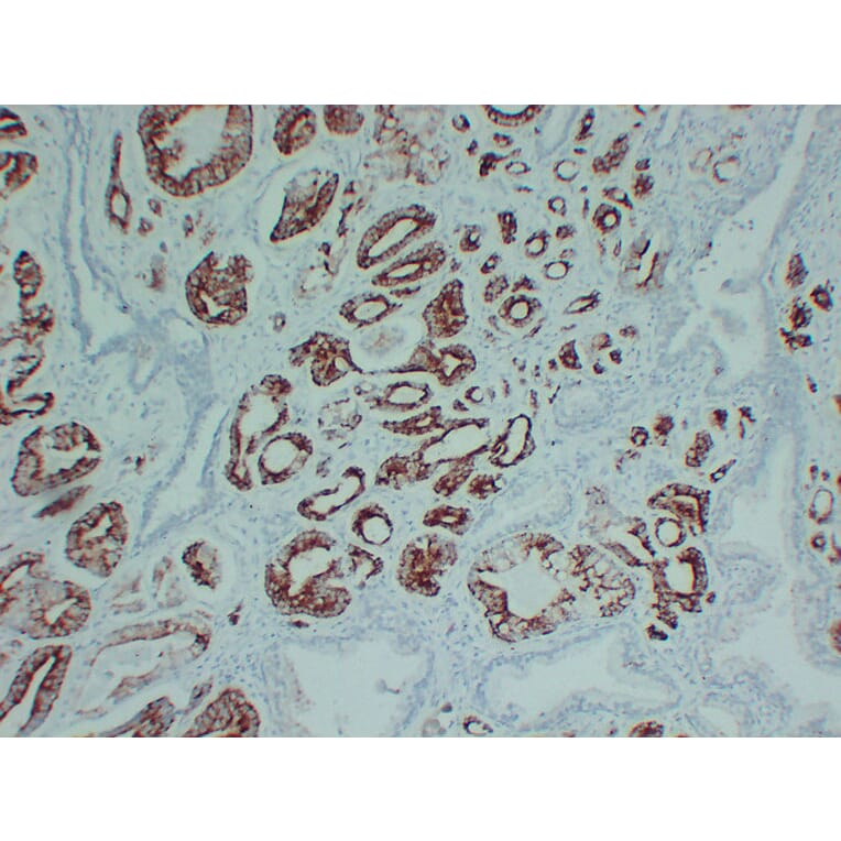 Immunohistochemistry - Anti-AMACR Antibody (V0006) - Antibodies.com
