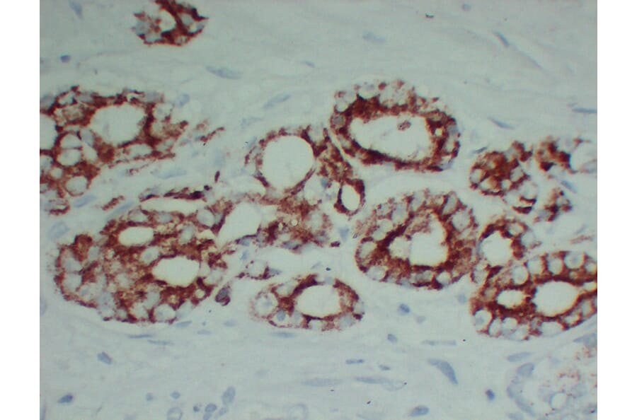 Immunohistochemistry - Anti-AMACR Antibody (V0006) - Antibodies.com