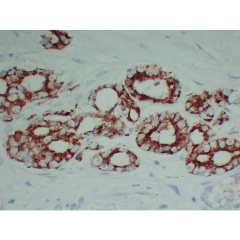 Immunohistochemistry - Anti-AMACR Antibody (V0006) - Antibodies.com