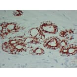 Immunohistochemistry - Anti-AMACR Antibody (V0006) - Antibodies.com