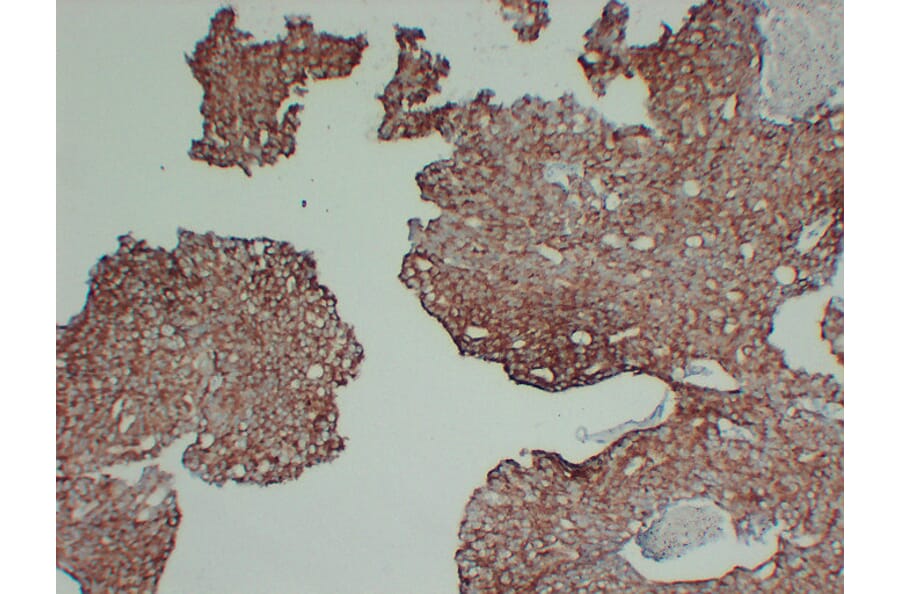 Immunohistochemistry - Anti-AMACR Antibody (V0006) - Antibodies.com