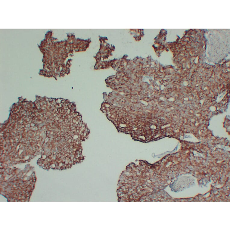 Immunohistochemistry - Anti-AMACR Antibody (V0006) - Antibodies.com