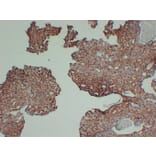 Immunohistochemistry - Anti-AMACR Antibody (V0006) - Antibodies.com