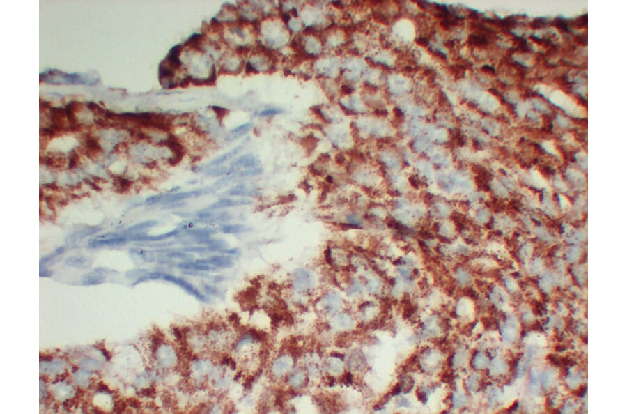 Immunohistochemistry - Anti-AMACR Antibody (V0006) - Antibodies.com
