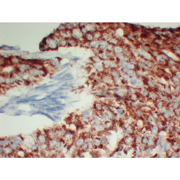 Immunohistochemistry - Anti-AMACR Antibody (V0006) - Antibodies.com