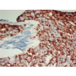 Immunohistochemistry - Anti-AMACR Antibody (V0006) - Antibodies.com