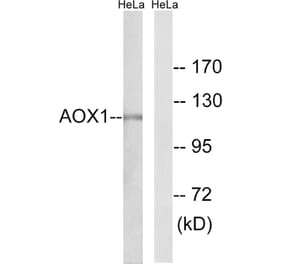 Western Blot - Anti-AOX1 Antibody (C14391) - Antibodies.com