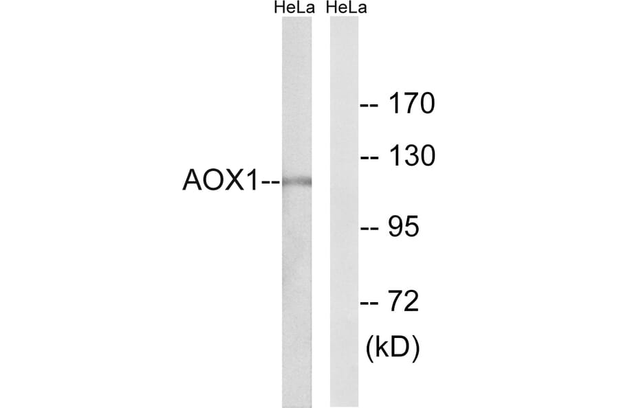 Western Blot - Anti-AOX1 Antibody (C14391) - Antibodies.com