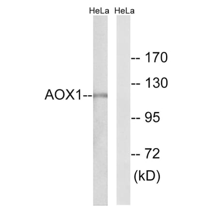 Western Blot - Anti-AOX1 Antibody (C14391) - Antibodies.com