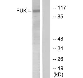 Western Blot - Anti-FUK Antibody (C11334) - Antibodies.com