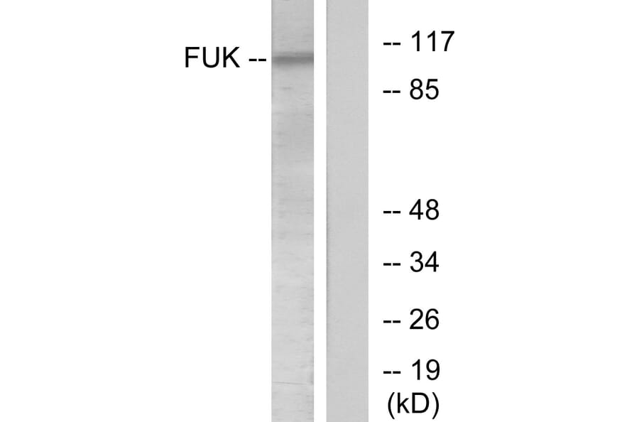 Western Blot - Anti-FUK Antibody (C11334) - Antibodies.com
