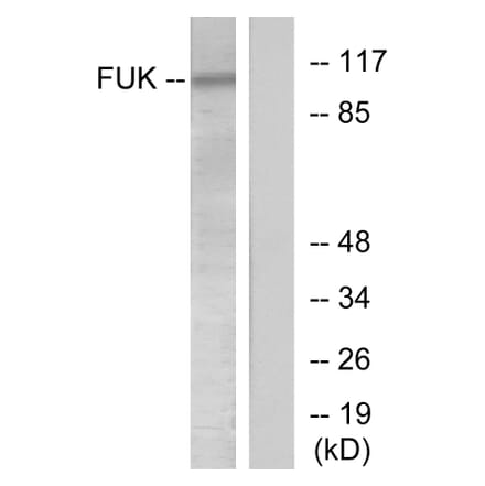 Western Blot - Anti-FUK Antibody (C11334) - Antibodies.com