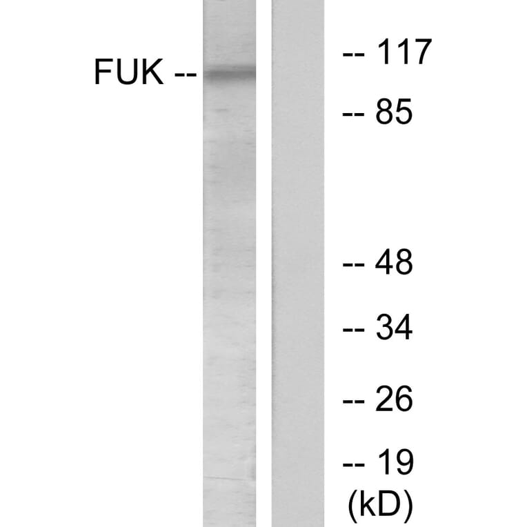 Western Blot - Anti-FUK Antibody (C11334) - Antibodies.com