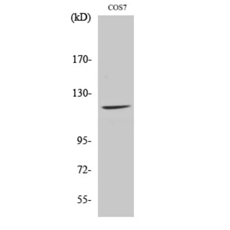 Western Blot - Anti-FUK Antibody (C11334) - Antibodies.com