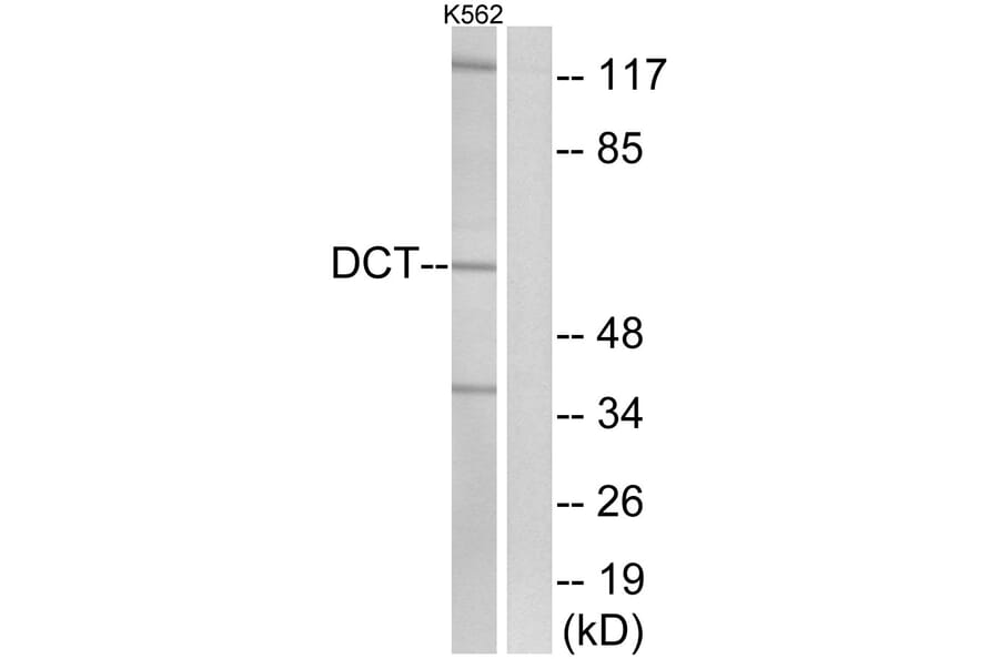 Western Blot - Anti-DCT Antibody (C16449) - Antibodies.com