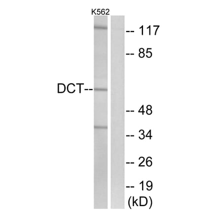 Western Blot - Anti-DCT Antibody (C16449) - Antibodies.com