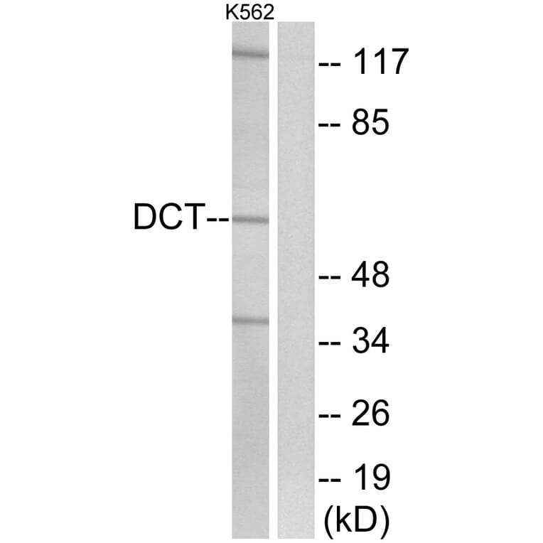 Western Blot - Anti-DCT Antibody (C16449) - Antibodies.com