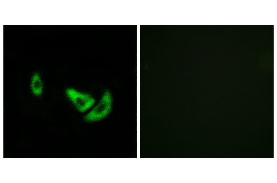 Immunofluorescence - Anti-DCT Antibody (C16449) - Antibodies.com