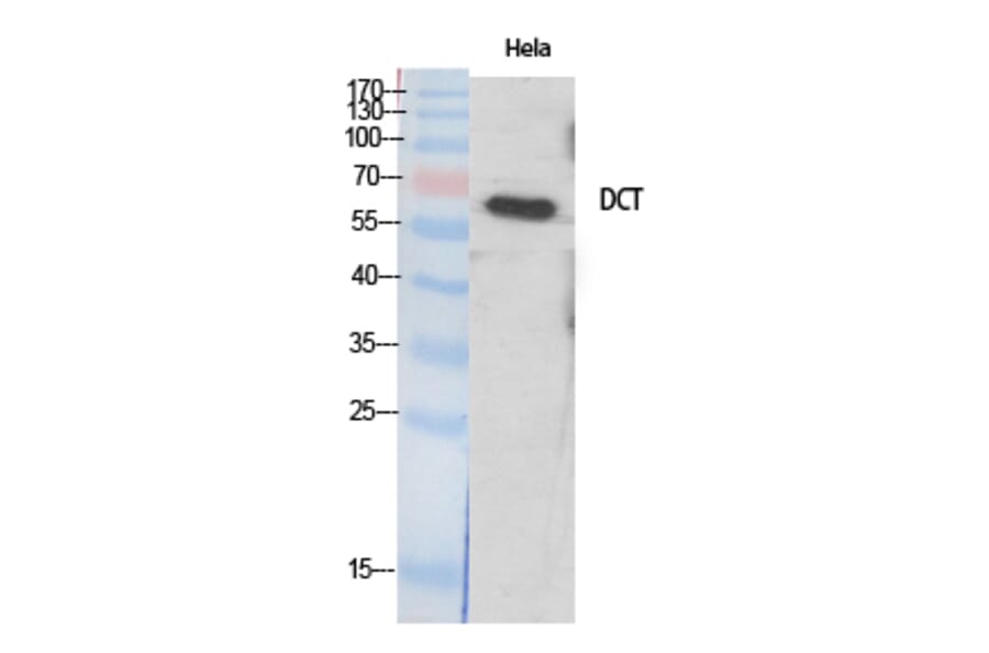 Western Blot - Anti-DCT Antibody (C16449) - Antibodies.com