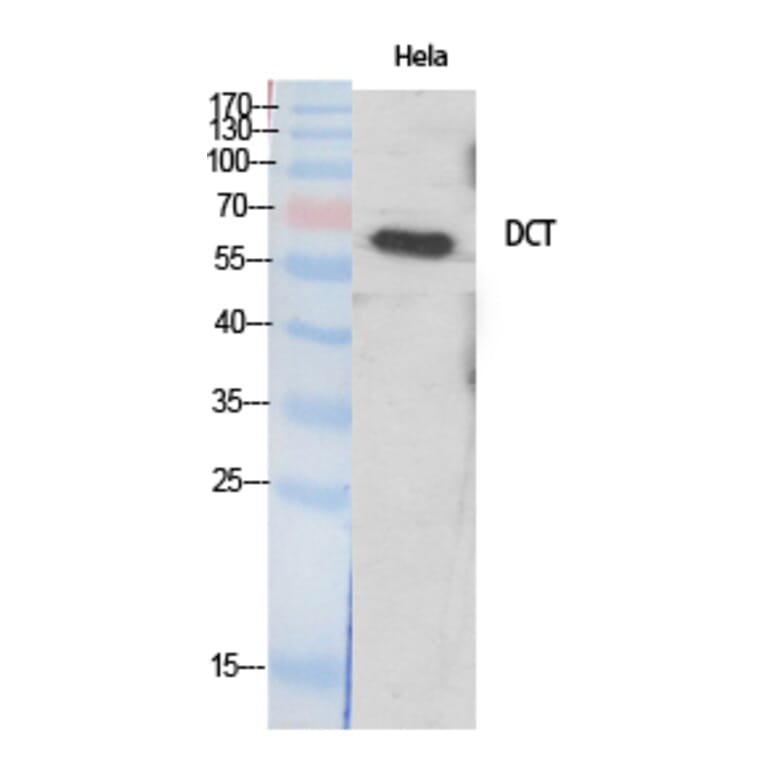Western Blot - Anti-DCT Antibody (C16449) - Antibodies.com