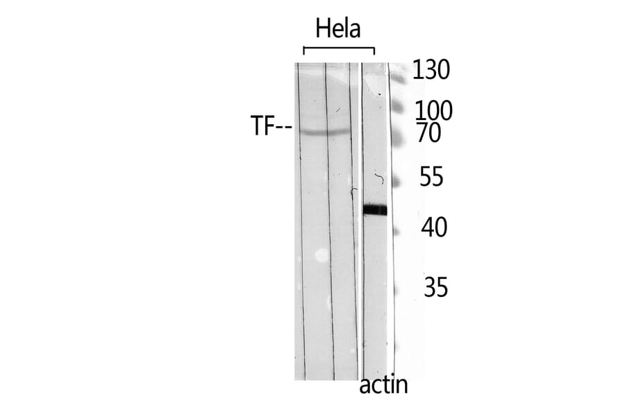 Western Blot - Anti-TF Antibody (C30311) - Antibodies.com